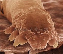 eyelash mite